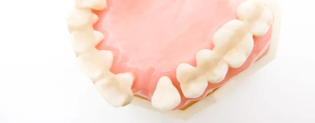 歯を失ってしまった方へ